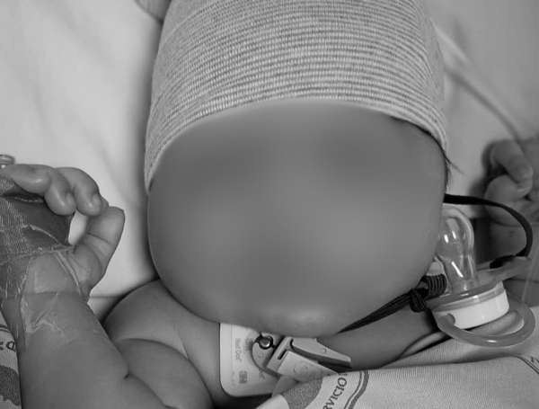 Imagen de referencia del bebé de Bosconia que esperaba atención especializada por una cardiopatía congénita